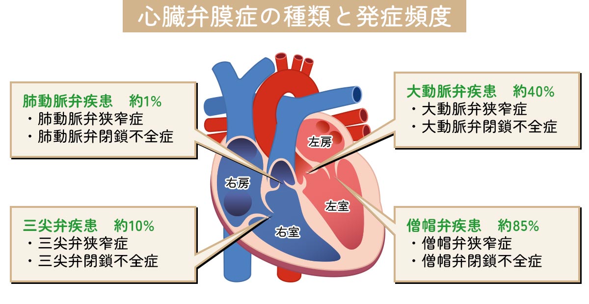 弁膜症